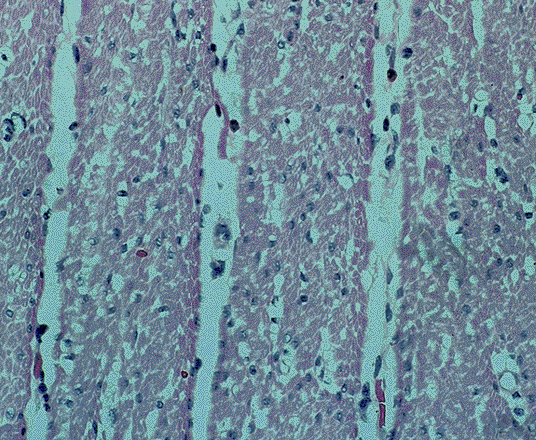 Imágenes del tejido muscular liso Músculo liso de la Trompa de Falopio con fibroblastos sobre su