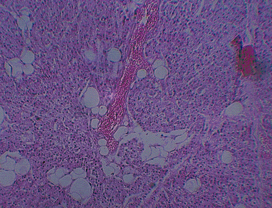 Imágenes de tejido glandular. Células secretoras paratiroides. Microfotografía.