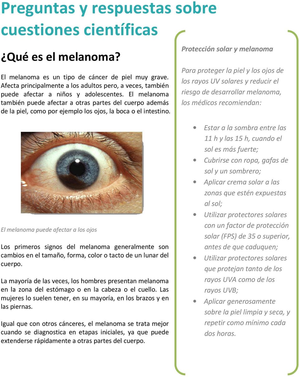 El melanoma también puede afectar a otras partes del cuerpo además de la piel, como por ejemplo los ojos, la boca o el intestino.