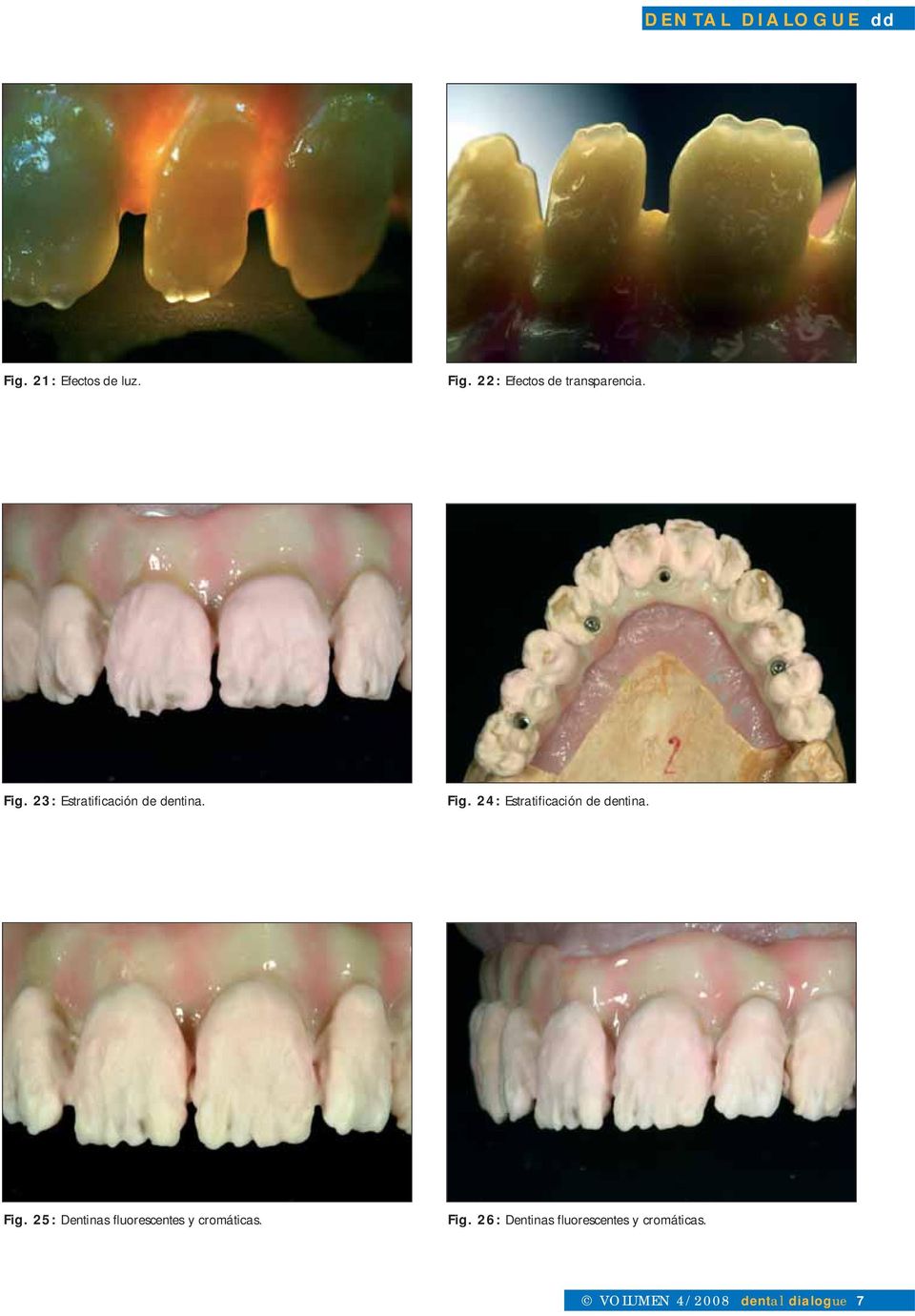 25: Dentinas fluorescentes y cromáticas. Fig.