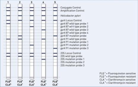 Métodos genotípicos Técnicas biología molecular: PCR