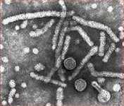 Sífilis Causada por la bacteria Treponema pallidum. Se transmite casi siempre por contacto sexual y también puede pasar de la madre al feto.