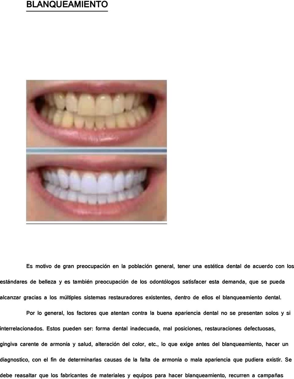 Por lo general, los factores que atentan contra la buena apariencia dental no se presentan solos y si interrelacionados.
