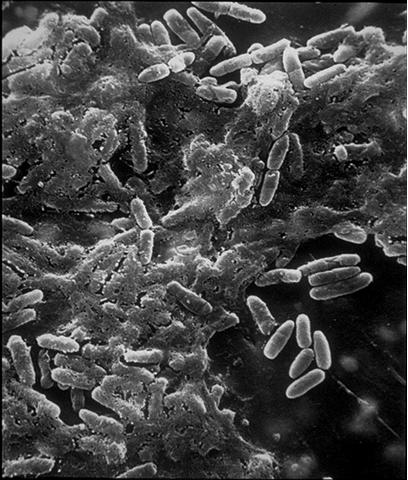 TRATAMIENTO Antibióticos sistémicos Eliminan bacteriemia Fallan para esterilizar la línea (70%) Biofilm Polisacáridos