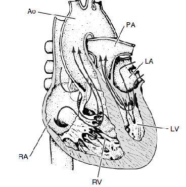 seccionar cada gran arteria por encima de las válvulas y colocarlas a sus lugares normales 44,49,99.