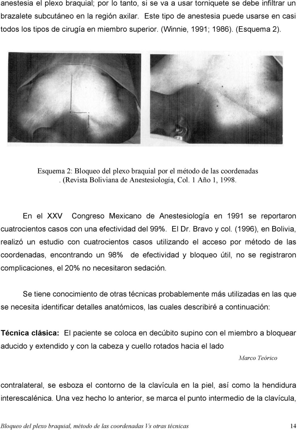 (Revista Boliviana de Anestesiología, Col. 1 Año 1, 1998. En el XXV Congreso Mexicano de Anestesiología en 1991 se reportaron cuatrocientos casos con una efectividad del 99%. El Dr. Bravo y col.