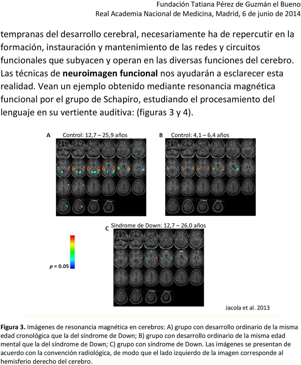 Vean un ejemplo obtenido mediante resonancia magnética funcional por el grupo de Schapiro, estudiando el procesamiento del lenguaje en su vertiente auditiva: (figuras 3 y 4).