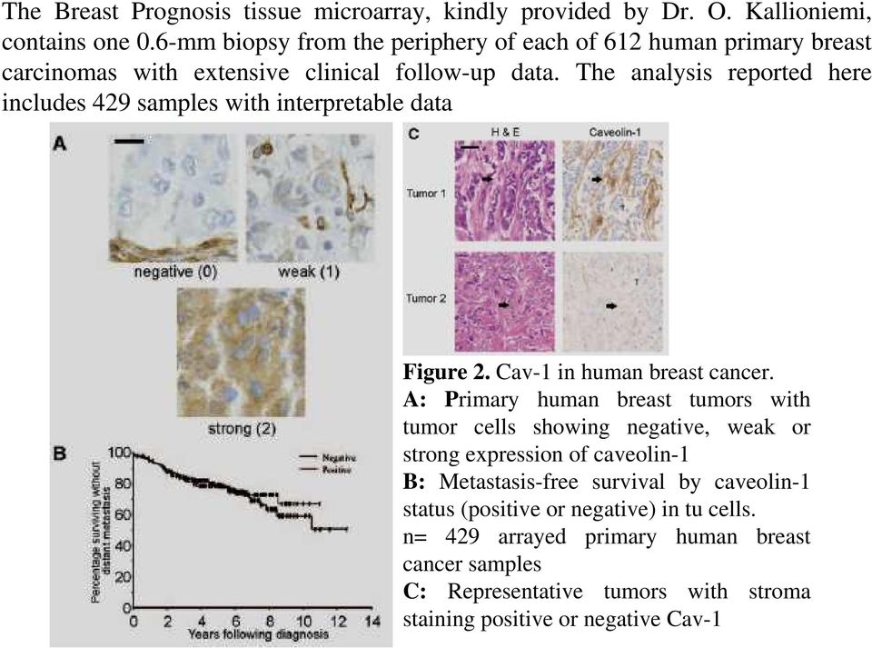 The analysis reported here includes 429 samples with interpretable data Figure 2. Cav-1 in human breast cancer.