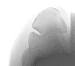 radiología de la articulación femorotibiorrotuliana Proyección caudocraneal (CCr) Proyección proximodistal (PxDi) o skyline Cóndilo lateral.