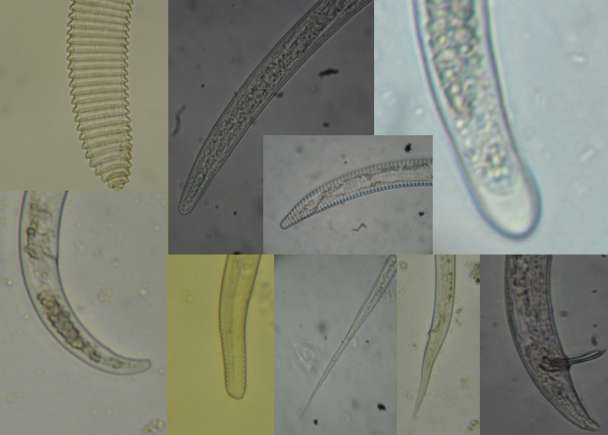 Figura 4. La región posterior de los nematodos poseen características específicas dependiendo del género que se trate. Generalmente los nematodos fitoparásitos tienen una longitud de 0.5 a 2.