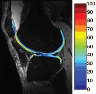 Advances in Magnetic Resonance Imaging of