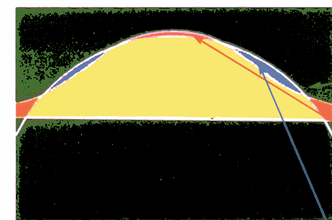 Mapa de Elevación La elevación viene dada por la altura de un punto de la superficie corneal con respecto a la superficie de una esfera de referencia.