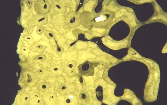 ACTIVIDADES DE LA PRÁCTICA Fig. 1: Corte transversal de tejido óseo maduro laminado compacto. Coloración: No posee.