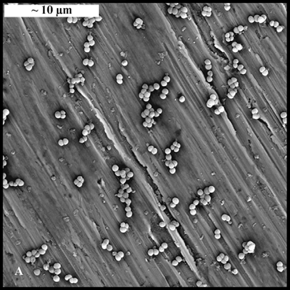 FUNDAMENTOS DE BIOENSUCIAMIENTO PORTADA REVISTA METALURGIA Micrografía de SEM (empleando electrones reetrodispersados) del Bioensuciamiento de un acero inoxidable austenítico