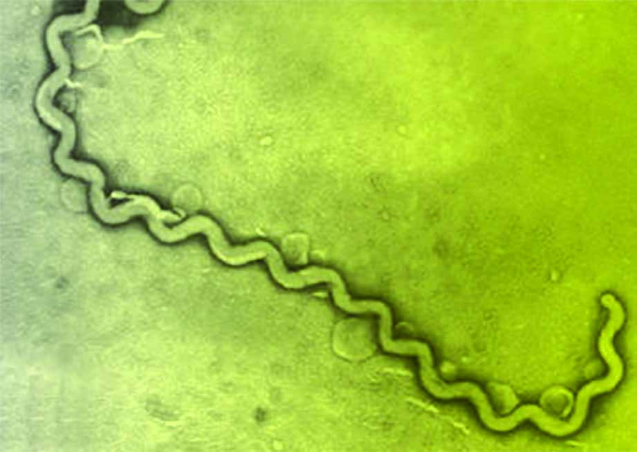 Qué es La Leptospirosis es una enfermedad infecciosa, producida por una bacteria llamada leptospiras, que se transmite a las personas con facilidad a través del agua y suelo, que ha sido contaminada