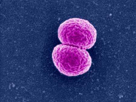 BO neumocócica 25% bacteriemia persistente / nuevos focos