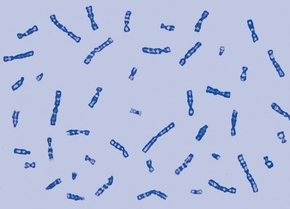 4 Elaboración de un cariotipo humano Recorta los cromosomas y pégalos en la plantilla, ordenándolos por tamaño y tipo de cromosoma.