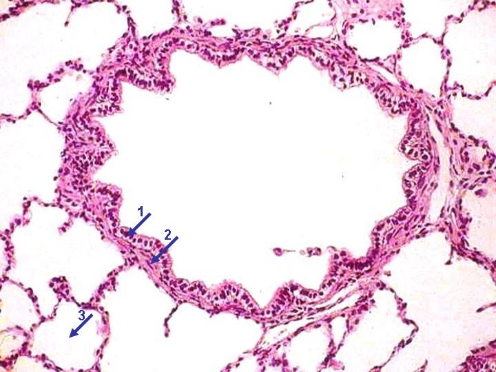 R/ 1. Película surfactante. 2. Citoplasma de la célula epitelial o neumocito tipo I. 3. Membrana basal de la célula epitelial. 4. Citoplasma de la célula endotelial. 5.