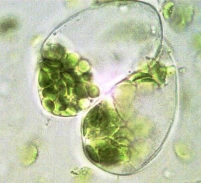 Protoplastos vegetales Protoplasto: es una célula vegetal, bacteriana o fúngica