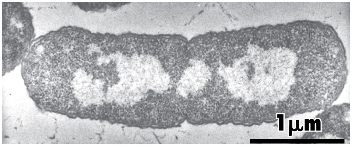 Cromosomas procariotas Concepto tradicional: Escherichia coli En