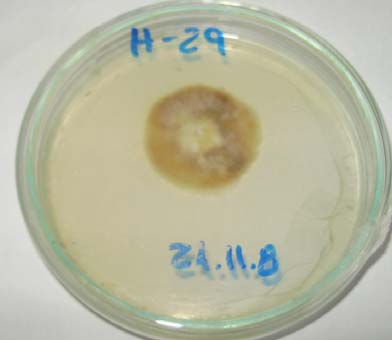 Preparación n hongos. Reproducción en medio de cultivo agar-malta.