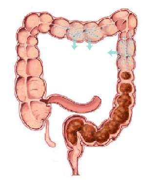 MATERIA FECAL Cuando el quimo permanece de 3 a 10 horas en el intestino grueso se vuelve semisólido por la absorción activa del agua.