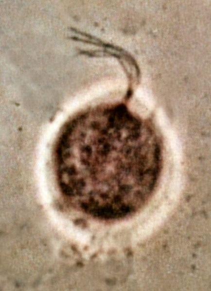 Trichomonadas Trichomonas vaginalis es un protozoo flagelado anaeróbico, agente causante de la