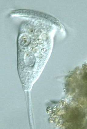FORMAS NUCLEARES Núcleo arrosariado del Stentor (protozoo ciliado) Núcleo