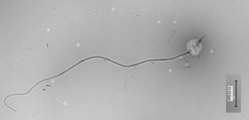 Fig. 1. Espermatozoide de Crotalus spp con morfología clasica. 1000 X. Fig. 2. Espermatozoide de Crotalus atrox con estrés osmótico en la región de la cabeza.1000x, la barra indica 10 µm.