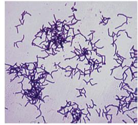 Las esporas (bien dentro de las conservas o bien ingeridas) revierten al Clostridium y éste produce toxinas A, B, E, F en nuestro intestino. El botulismo es una forma de intoxicación aguda muy grave.