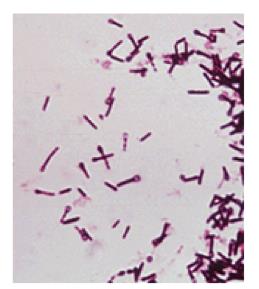 nosocomiales), pueden degenerar en una colitis pseudomembranosa (irritación del colon con formación de pseudomembranas).
