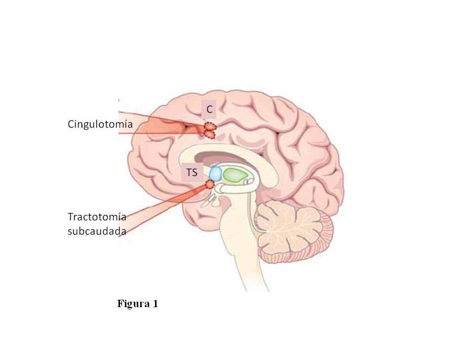 8 Figura 1: Esquema del cerebro en el plano sagital medio, mostrando
