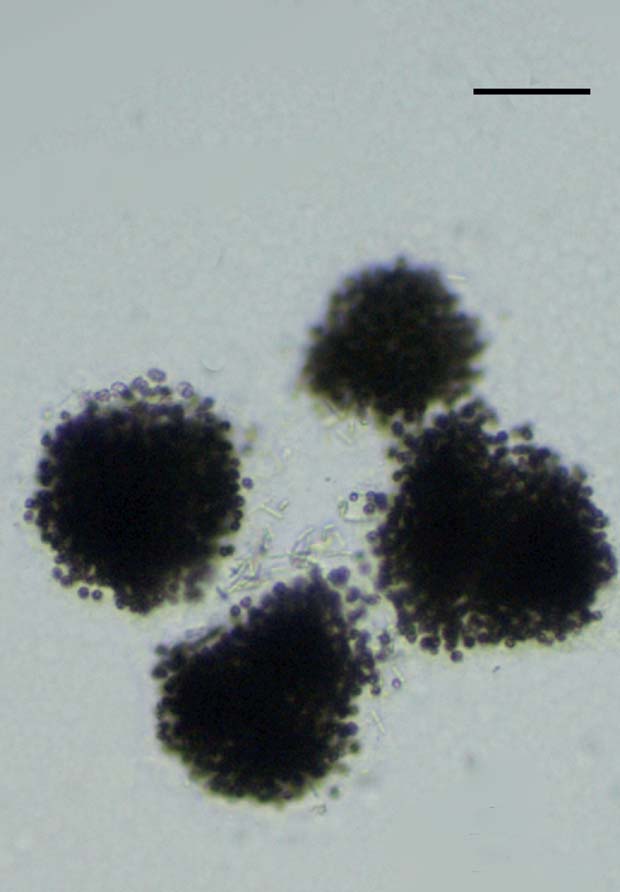 Microcystis novacekii Descripciones: especies Barra de escala = 50 µm Barra de escala = 10 µm P: Pseudanabaena mucicola (cianobacteria) en el mucílago de