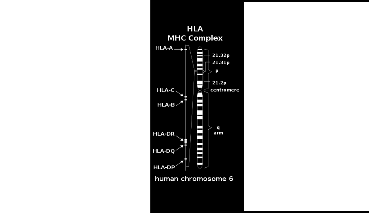 Tema 4 Máster en Trasplante Hematopoyético Módulo 8 Indicaciones y resultados del TPH alogénico familiar TPH alogénico