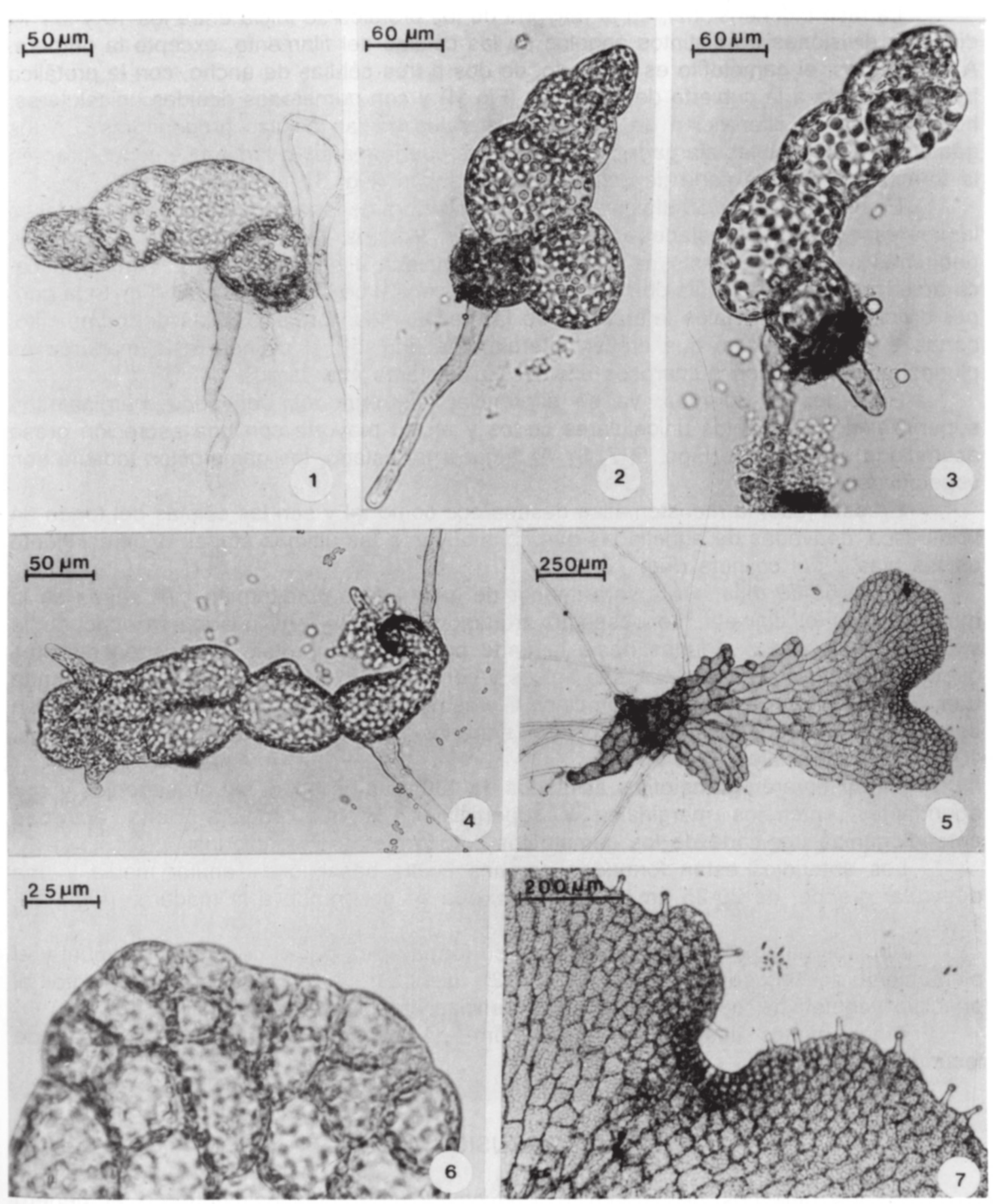 Pérez-García, et al.: Observaciones del Gametofito de Thelypteris rhachiflexuosa Figs. 1-7.- Morfogénesis del gametofito de Thelypteris rhachiflexuosa. 1-2.