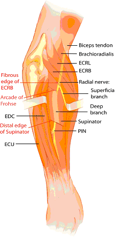 figura 2 Por último la presión crónica por uso de tijeras, causaría la lesión de la rama digital dorsal del nervio radial Aunque la relación de actividades recogidas nunca debe entenderse cerrada, lo