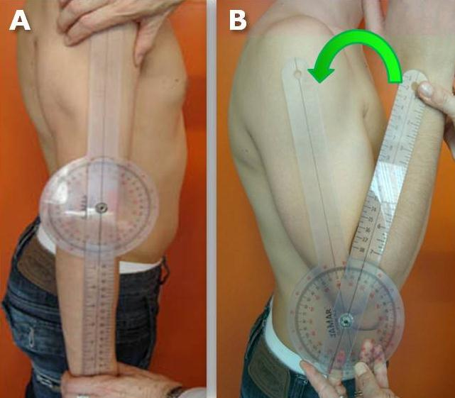 goniométricamente, se coloca al paciente en bipedestación con el brazo a lo largo del tronco y el codo en extensión (palma de la mano enfrentada al muslo).
