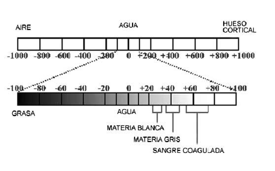 Patiño Chimbo 29 Figura 2.5: Escala y unidades de hounsfield. (MÓDULO TÉCNICA RADIOLOGÍCA. La Escala de Hounsfield. 2012) [ref. 5 de Febrero de 2013] Fuente: http://modulotecguana.blogspot.