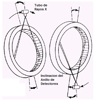 Patiño Chimbo 44 Figura 3.5: Movimiento de inclinación del anillo de detectores. (DALCAME, Conceptos Tomografía. [s.a.]. pág. 15) [ref. 24 de Febrero de 2013] Fuente: http://www.dalcame.