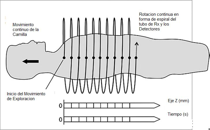 Patiño Chimbo 53 Figura 4.2: Ilustración de movimiento en espiral que se produce en la tomografía helicoidal. Fuente: CURESES, Daniel. Principios de la Tomografía Axial Computada.