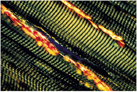 Técnicas de microscopia Microscopio de polarización Glomerulo renal con tinción de rojo Glomerulo renal con luz polarizada