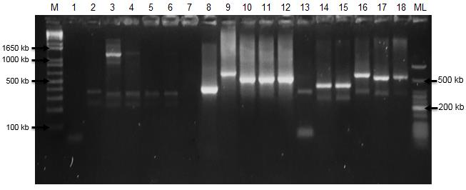 segundo carril de cada serie de MIRU evaluado. El tamaño de los productos de PCR varían de acuerdo al número de copias de MIRU presente en cada aislado.