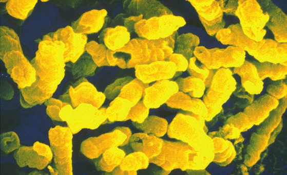 Bacteria Infecciones por Haemophilus