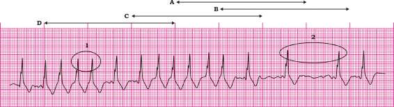 2.6. CÁLCULO DE LA FRECUENCIA CARDIACA Hay muchas fórmulas para de calcular la frecuencia cardiaca (FC), se citan las más utilizadas por su practicidad. 1.