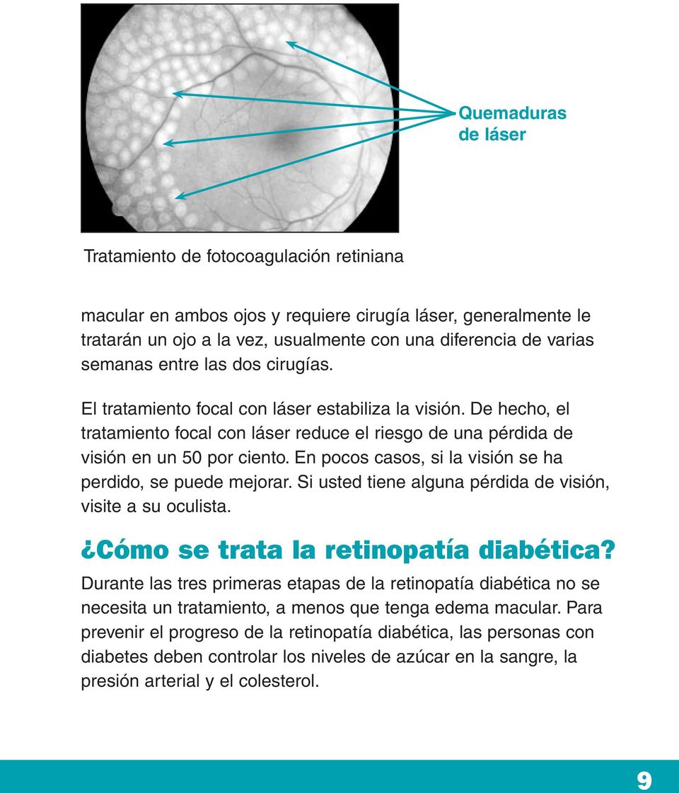 En pocos casos, si la visión se ha perdido, se puede mejorar. Si usted tiene alguna pérdida de visión, visite a su oculista. Cómo se trata la retinopatía diabética?