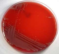 Stenotrophomonas maltophilia Bacilo Gram (-) aerobio estricto Intrínsecamente resistente La mayoría cultivos intermitentes 4º germen colonizante (12,6%) Achromobacter xylosoxidans Bacilo G (-) no