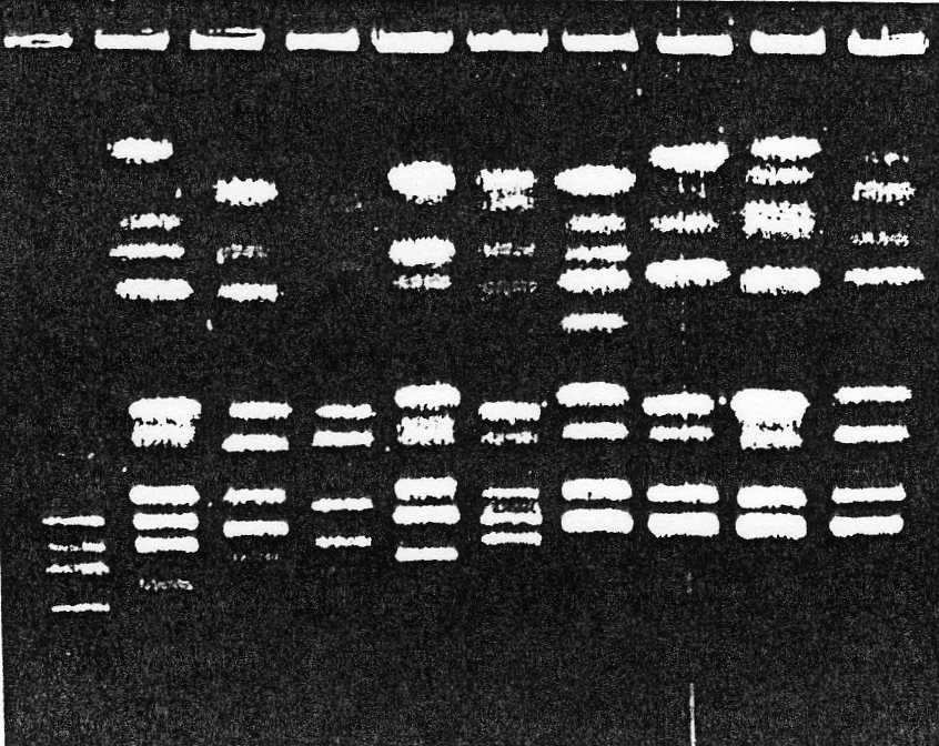 ELECTROFORESIS EN CAMPO PULSANTE El análisis de los cariotipos electroforéticos nos permite estimar número y tamaño de los cromosomas al compararlos con los marcadores de peso