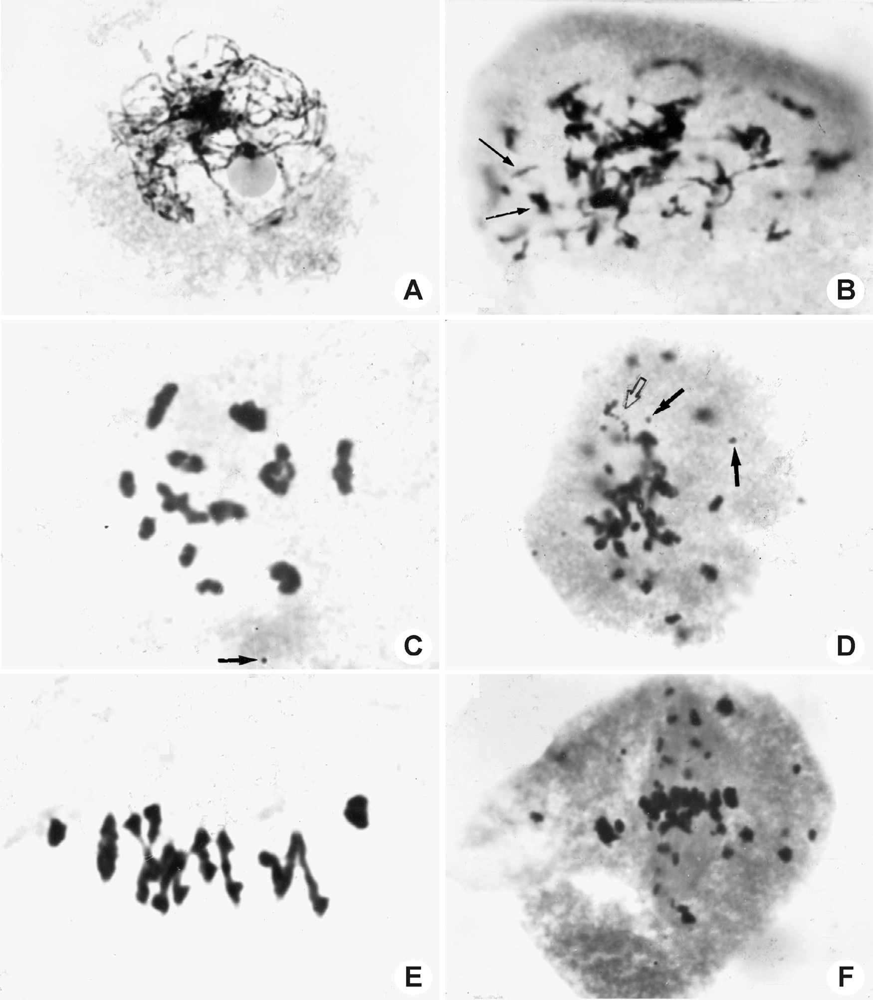 A. Fernández, Fragmentaciones cromosómicas en la meiosis de híbridos de Turnera ulmifolia (Turneraceae) Fig. 1. Meiosis en híbridos de T. ulmifolia. A: paquitene en T. ulmifolia x T.