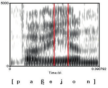 Figura 9. Distribución de las realizaciones fonéticas halladas en el contexto /lj+vocal/ en los dos informantes.