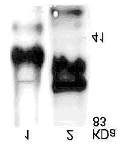 Efecto de la refrigeración sobre los espermatozoides caninos Figura 5. Identificación de acrosina en espermatozoides caninos por Western Blot.